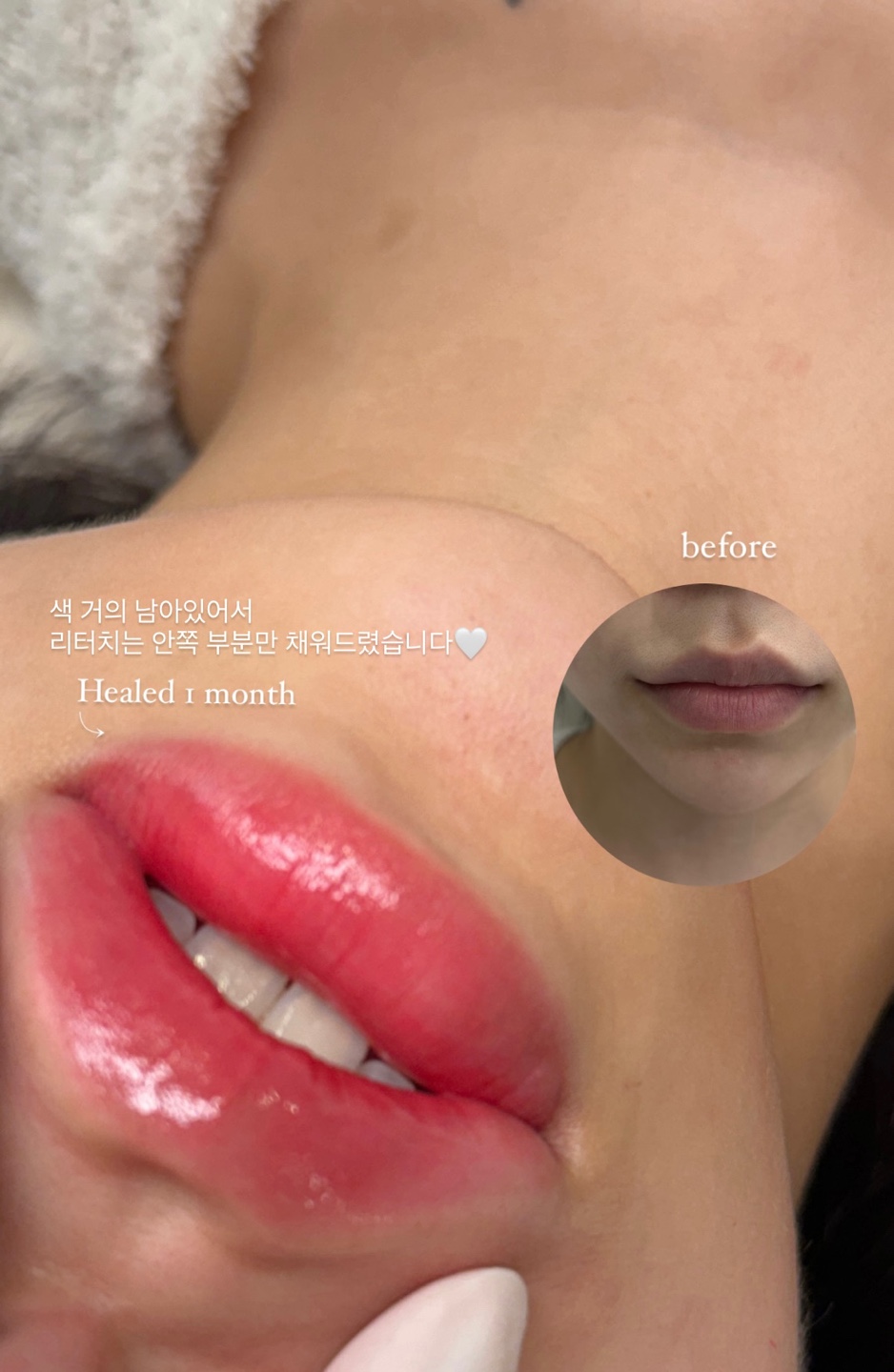 더뮤어 이미지