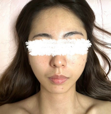 에스케어 이미지