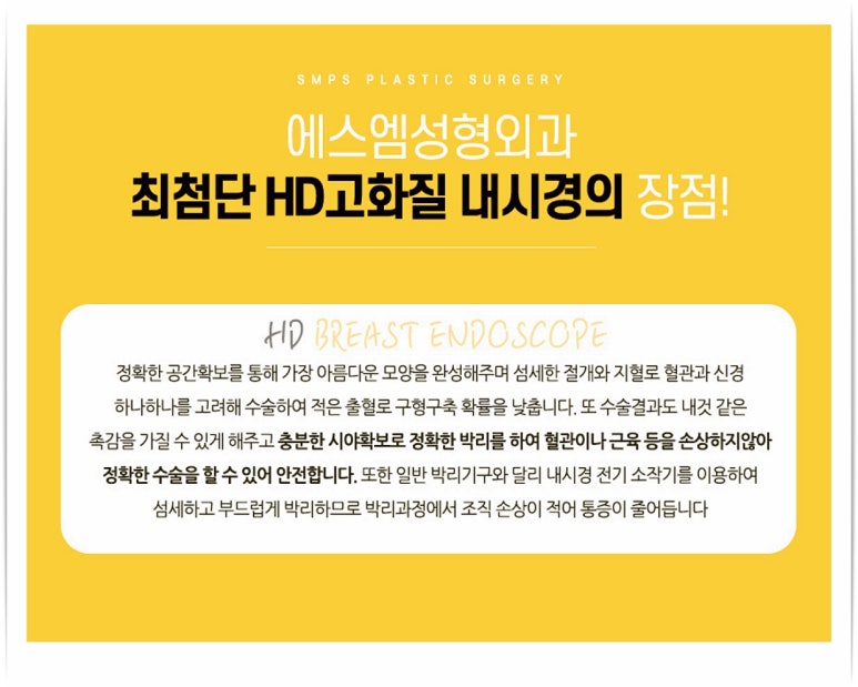 에스엠성형외과 이미지