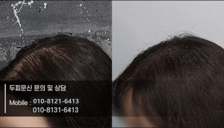 지지헤어 이미지