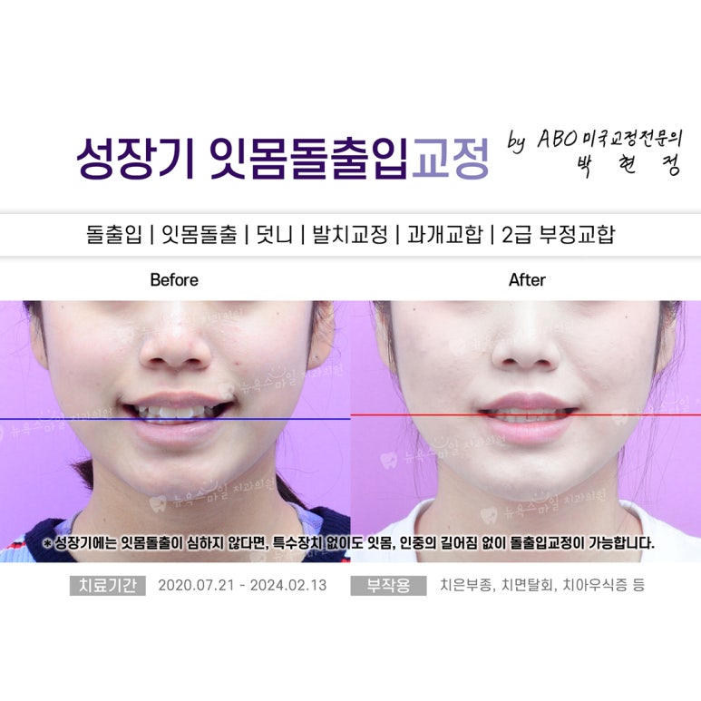 서면뉴욕치과의원 이미지