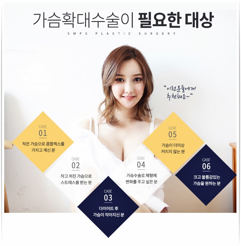 에스엠성형외과 이미지