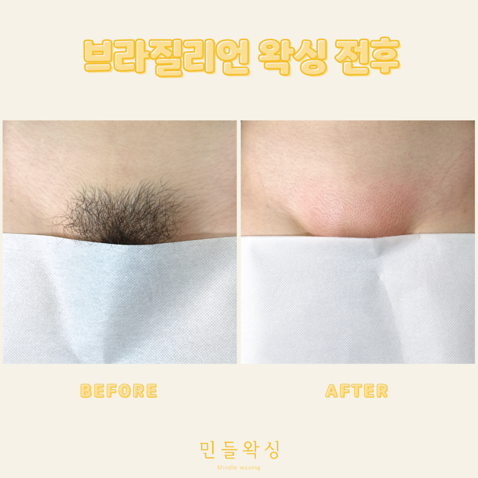 민들왁싱 이미지