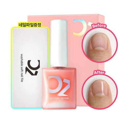 오즈네일 이미지