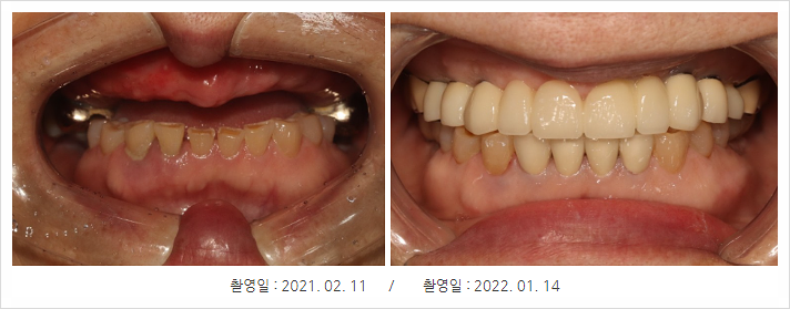 부천한결치과 이미지