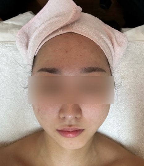 비알부티크 이미지