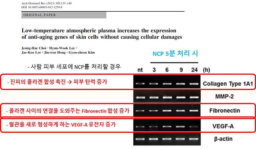 콜드플라즈마 이미지