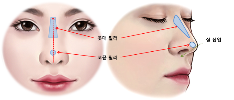 엄지연합의원 이미지