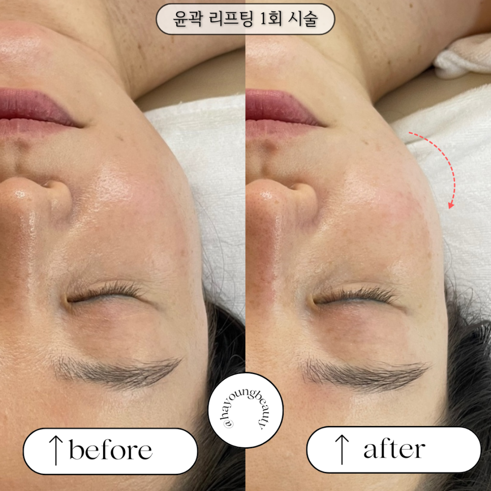 하영피부관리 이미지