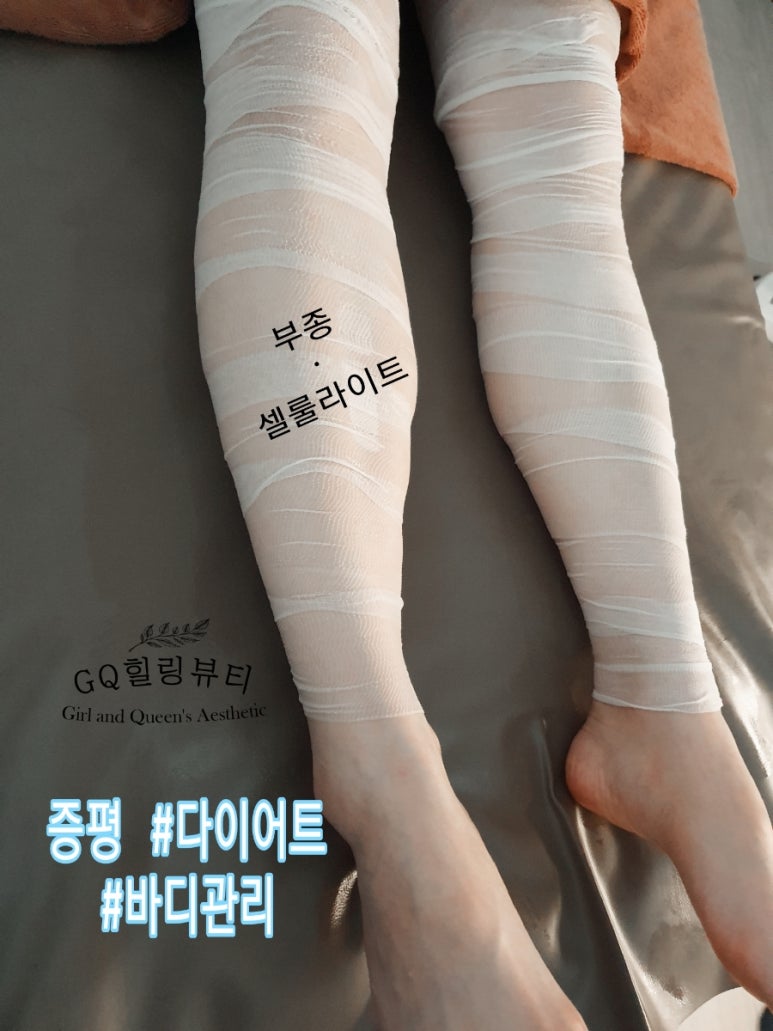 퀸바디케어 이미지
