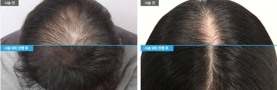 헤어온의원 이미지