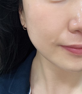 라퓨어왁싱 이미지