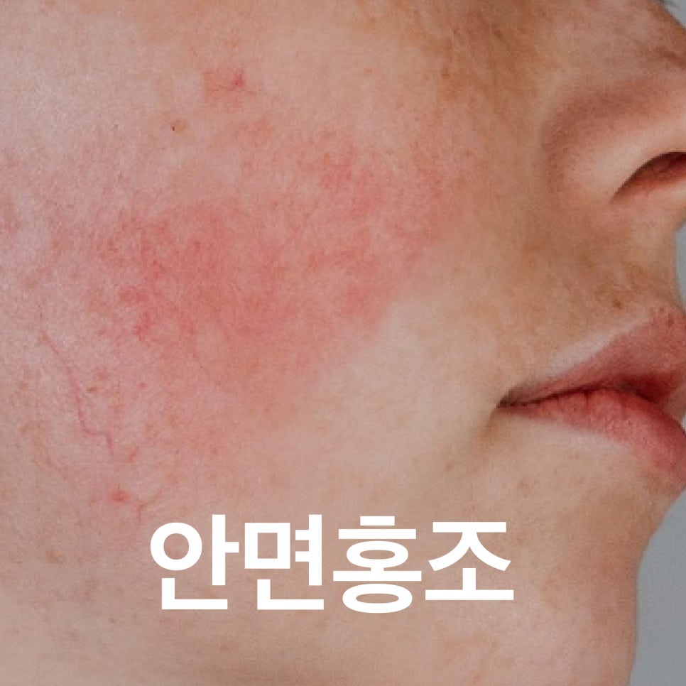 송도오라클피부과 이미지
