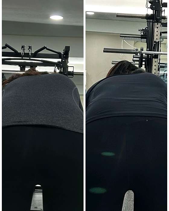 리메디PT 이미지