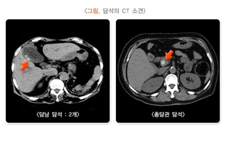 미소들노인전문병원 이미지