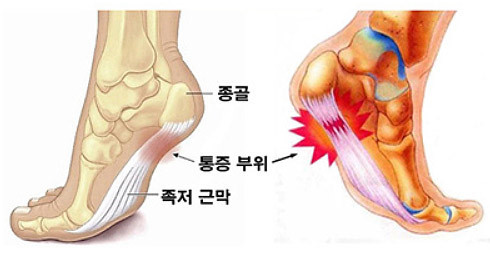 중앙정형외과의원 이미지