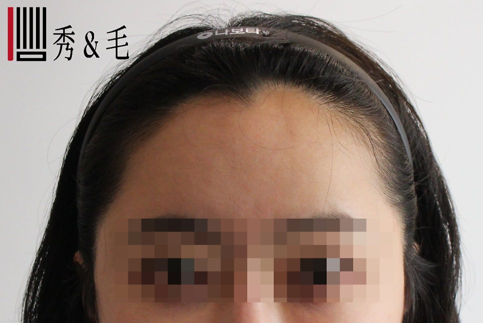 더헤어라인성형외과의원 이미지
