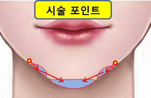 엄지연합의원 이미지