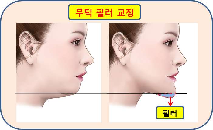엄지연합의원 이미지