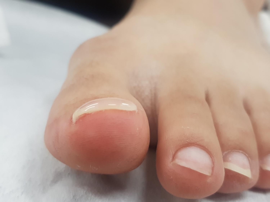 예뻐네일 이미지