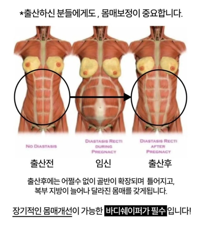 로벨 이미지