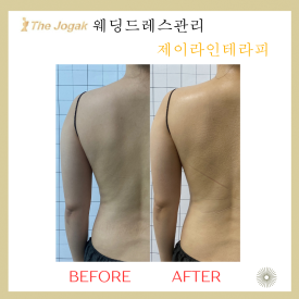 스마일테라피 이미지
