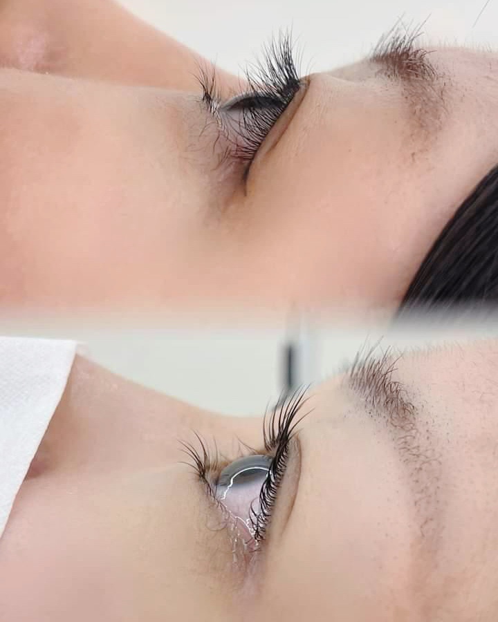 서이뷰티 이미지