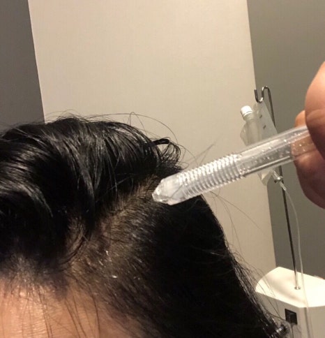메소드비 이미지