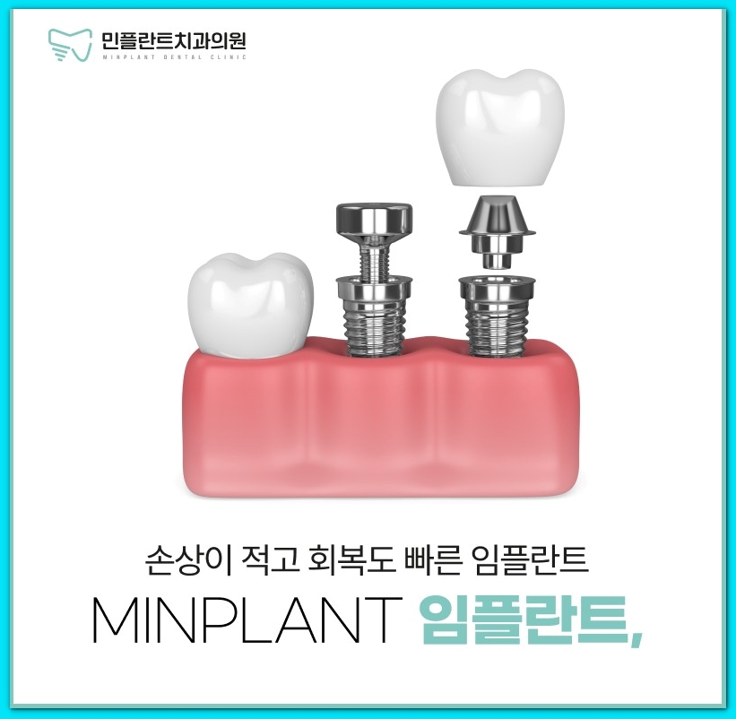 민플란트치과의원 이미지
