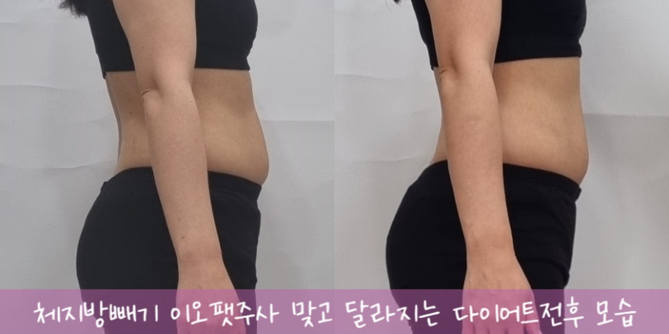 이오에어컨 이미지