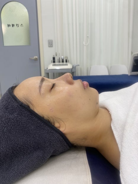 끌리네피부관리아중 이미지