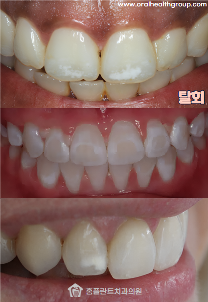 화이트플란트치과의원 이미지