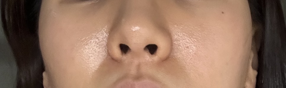 이지에스테틱 이미지