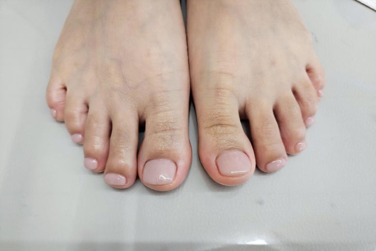블리엔네일 이미지