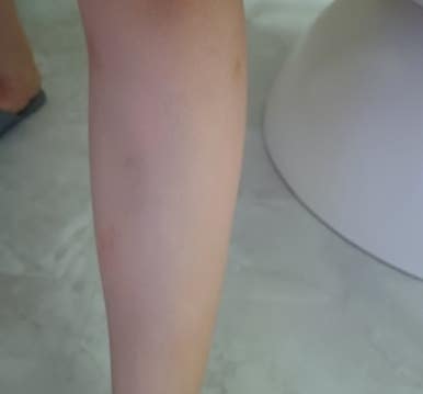 내포체형관리 이미지