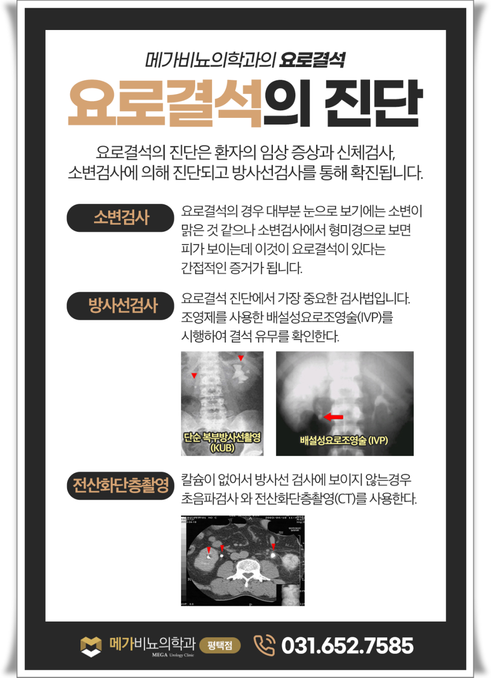 메가비뇨의학과 이미지