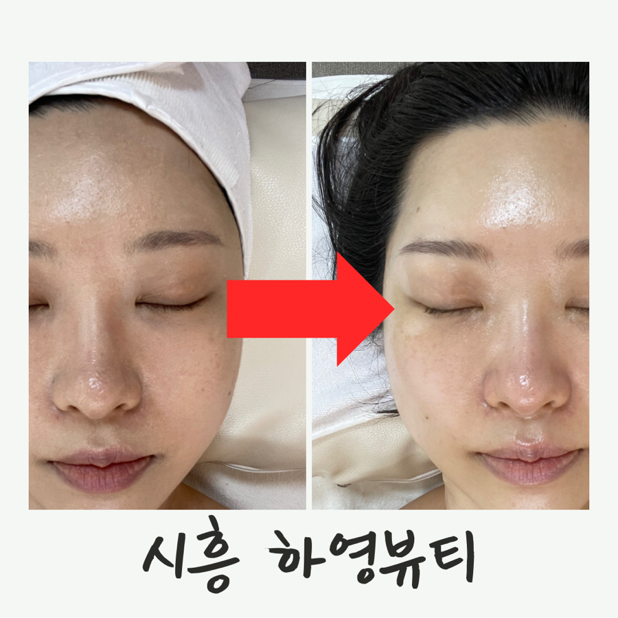 하영피부관리 이미지