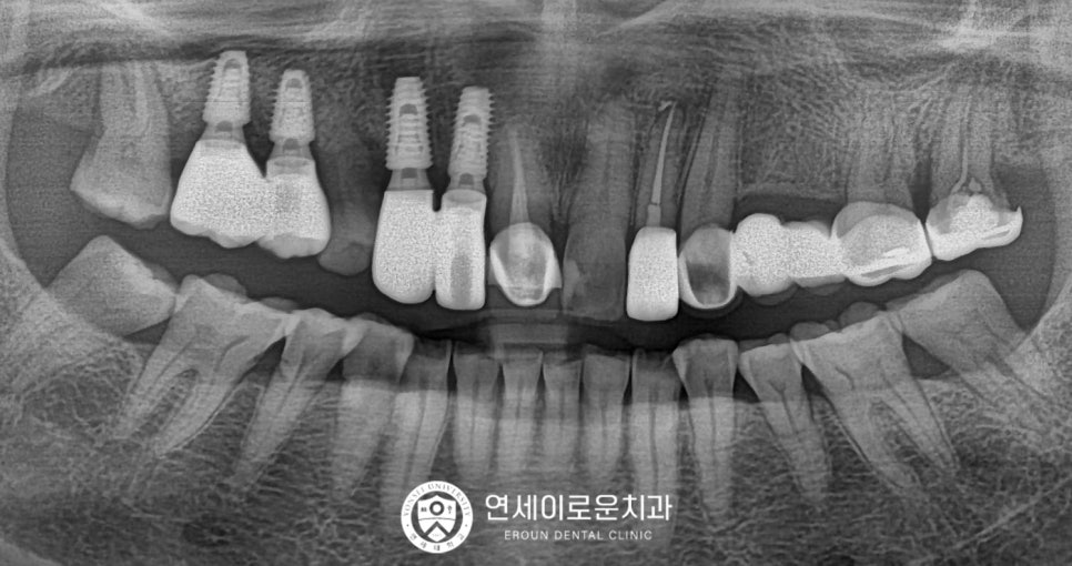 연세이로운치과의원 이미지
