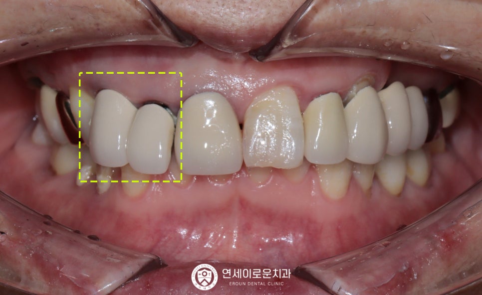 연세이로운치과의원 이미지