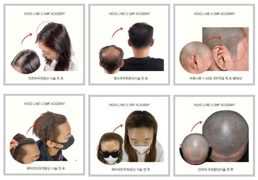 헤드라인유 이미지