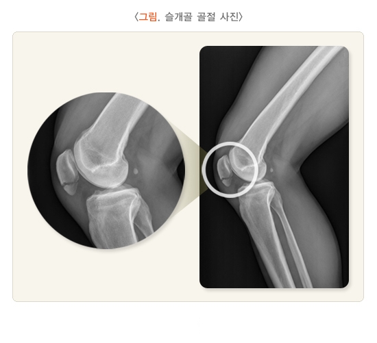 에스엘서울병원 이미지