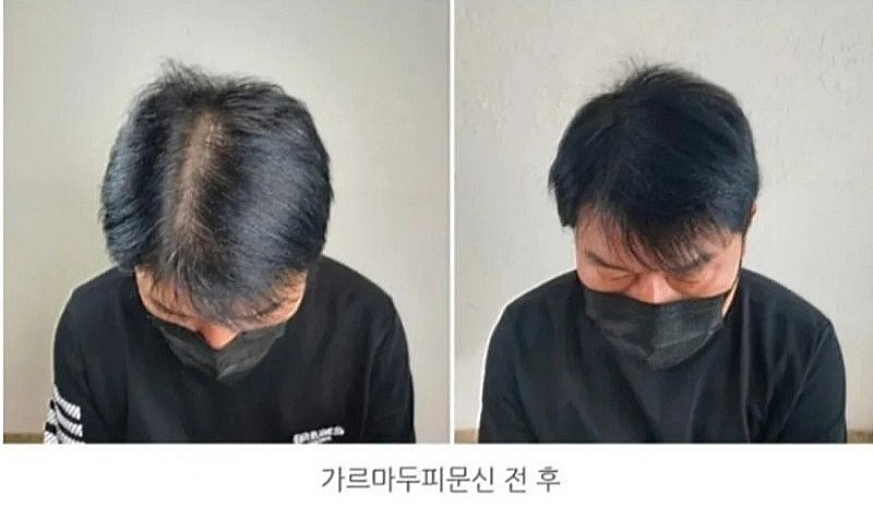 헤드라인유 이미지
