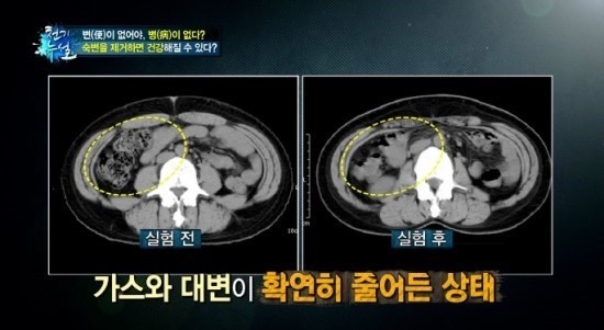 트윈스킨 이미지