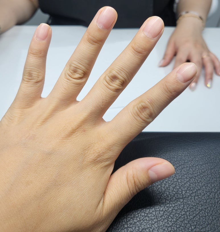 치라다네일 이미지