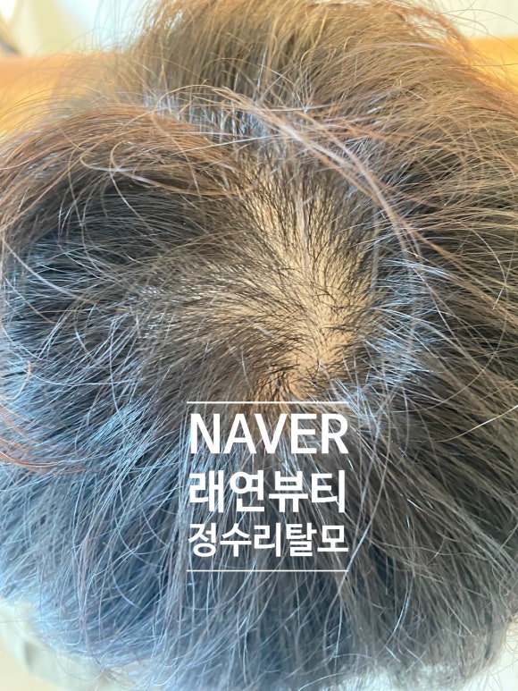 래연모이든 증모가발 토성점 이미지