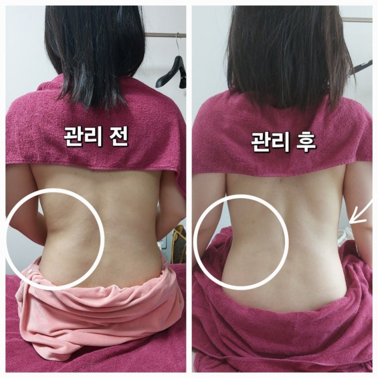 성남출장마사지 이미지