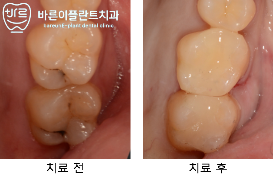 e-플란트치과 이미지
