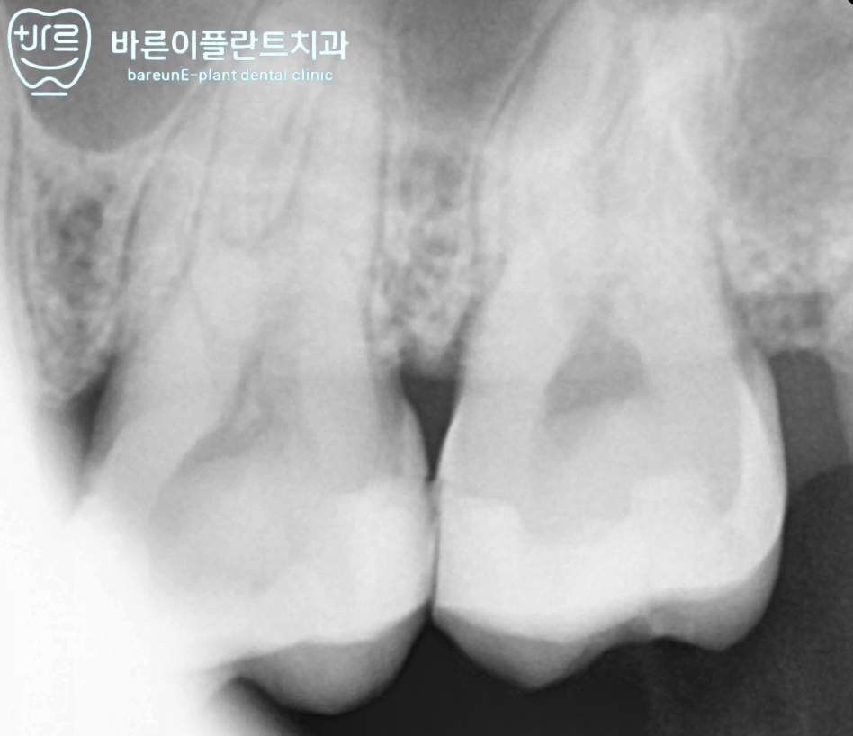 e-플란트치과 이미지