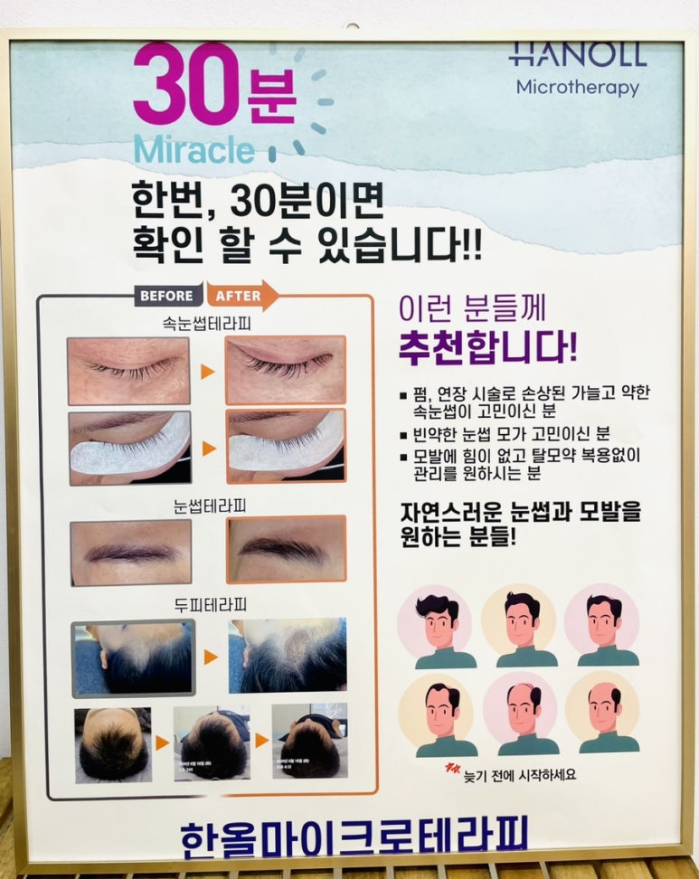 에스에스비 이미지
