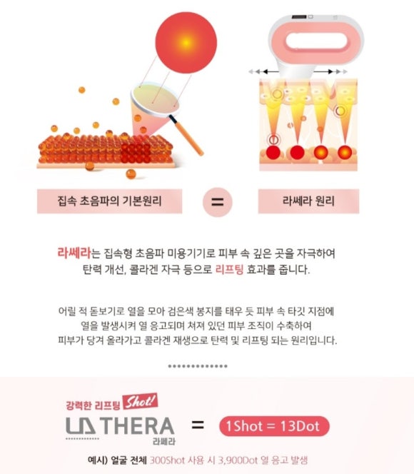 쎄라 이미지